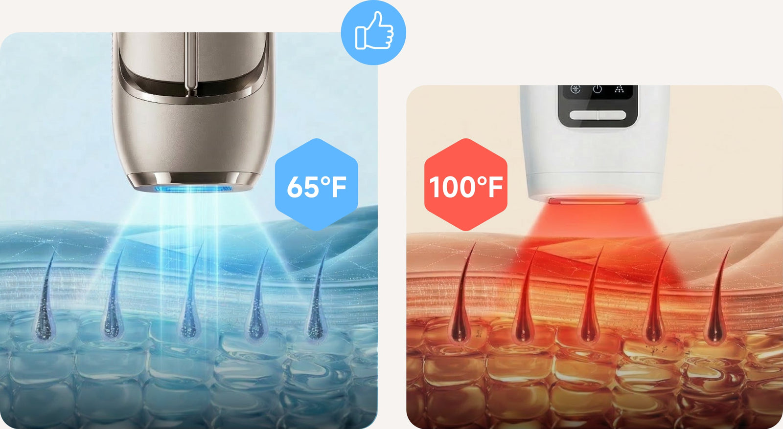 Dreame Nova IPL ontharingsapparaat Sapphire Ice koeling versus normale behandeling voor veiligheid